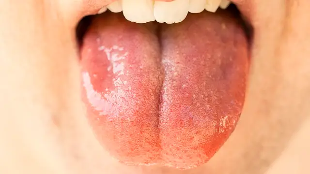 食事はよく噛むことで、病気予防やアンチエイジングになる?痩せるメリットも